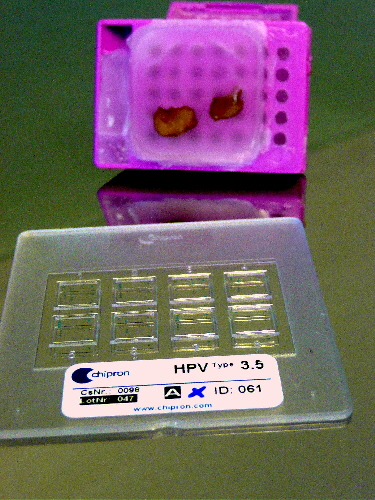 HPV_Chip