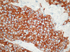 Immuno Her2/neu